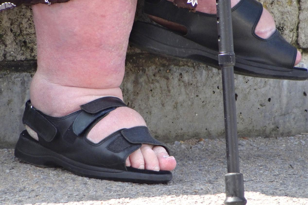 Sind 6E-Schuhe die Lösung für Ihre geschwollenen Füße?