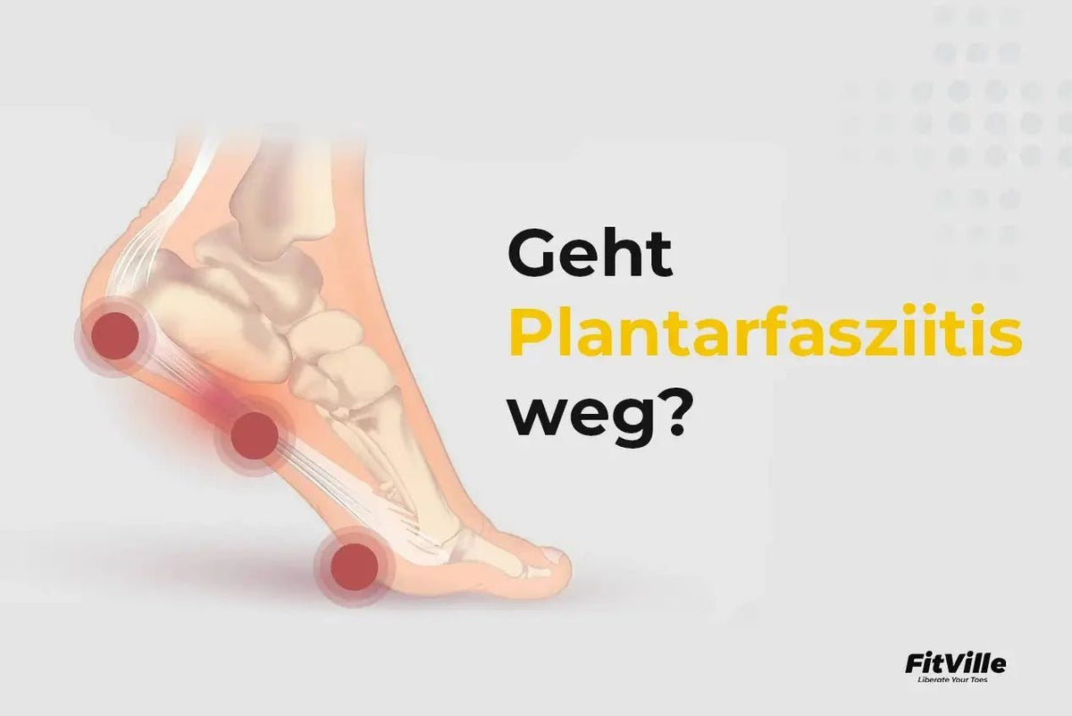 Geht Plantarfasziitis weg?